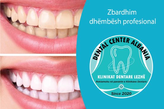 Zbardhim dhe drejtim dhëmbësh nga DENTAL CENTER LEZHA